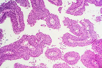 cancer-cells.jpg